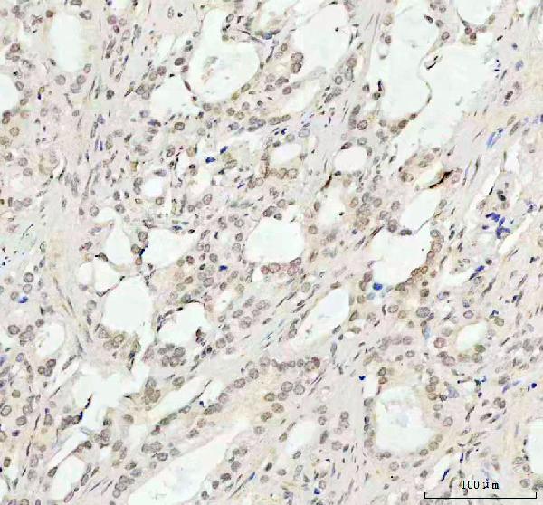 2 - Anti-Phospho-AKT1 (T450) Rabbit Monoclonal Antibody ABO13143
