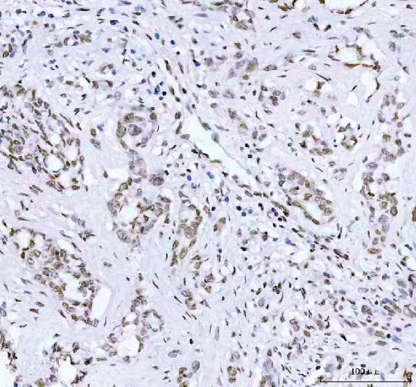 2 - Anti-Phospho-AKT1 (T450) Rabbit Monoclonal Antibody ABO13143