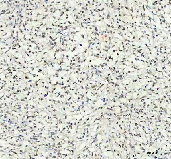 2 - Anti-Phospho-AKT1 (T450) Rabbit Monoclonal Antibody ABO13143