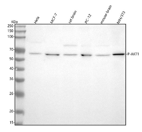 1 - Anti-Phospho-AKT1 (T450) Rabbit Monoclonal Antibody ABO13143