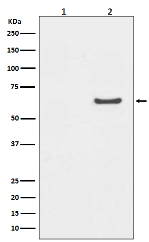 1 - Anti-Phospho-AKT1 (S129) Rabbit Monoclonal Antibody ABO13145
