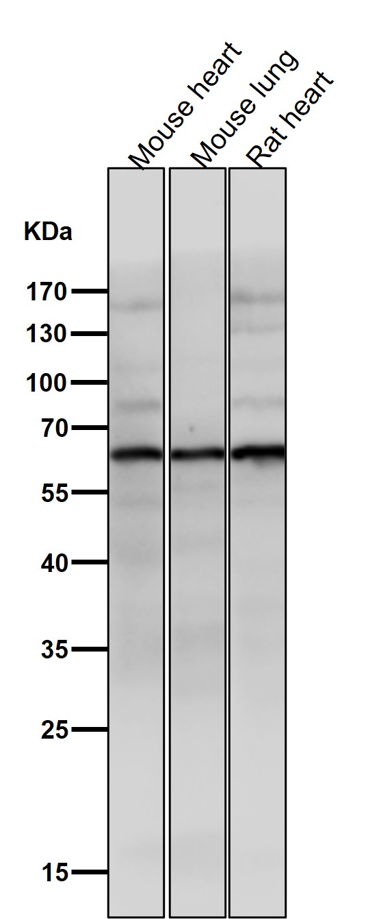 1 - Anti-Phospho-AKT1 (S129) Rabbit Monoclonal Antibody ABO13145