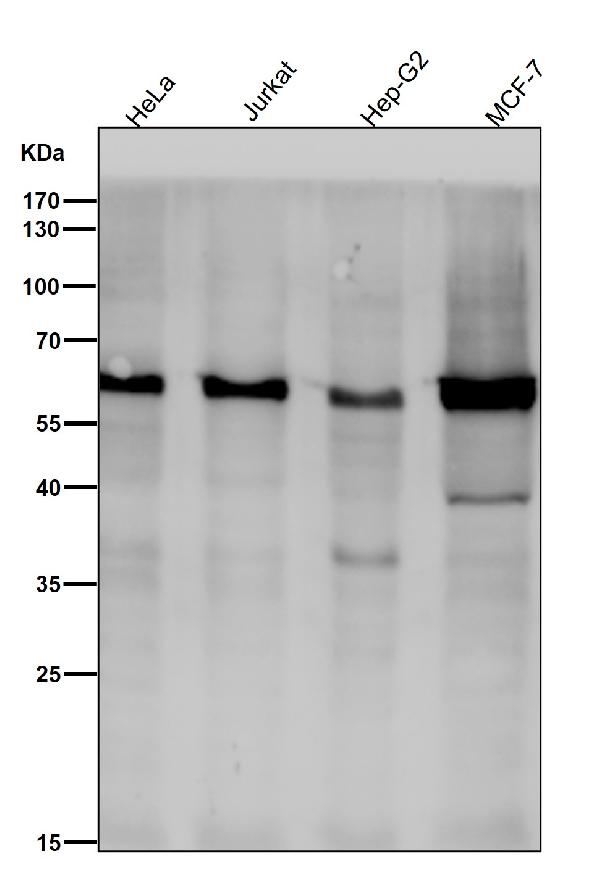 1 - Anti-Phospho-AKT1 (S129) Rabbit Monoclonal Antibody ABO13145