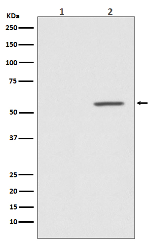 1 - Anti-Phospho-AKT1 (S124) Rabbit Monoclonal Antibody ABO13146