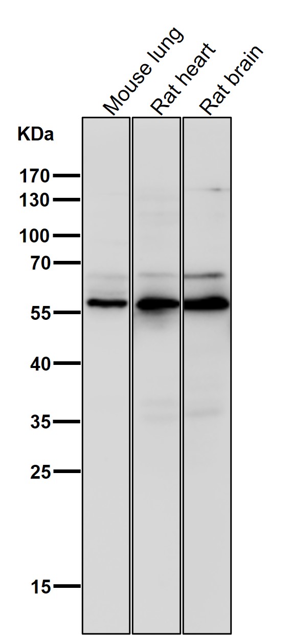 1 - Anti-Phospho-AKT1 (S124) Rabbit Monoclonal Antibody ABO13146