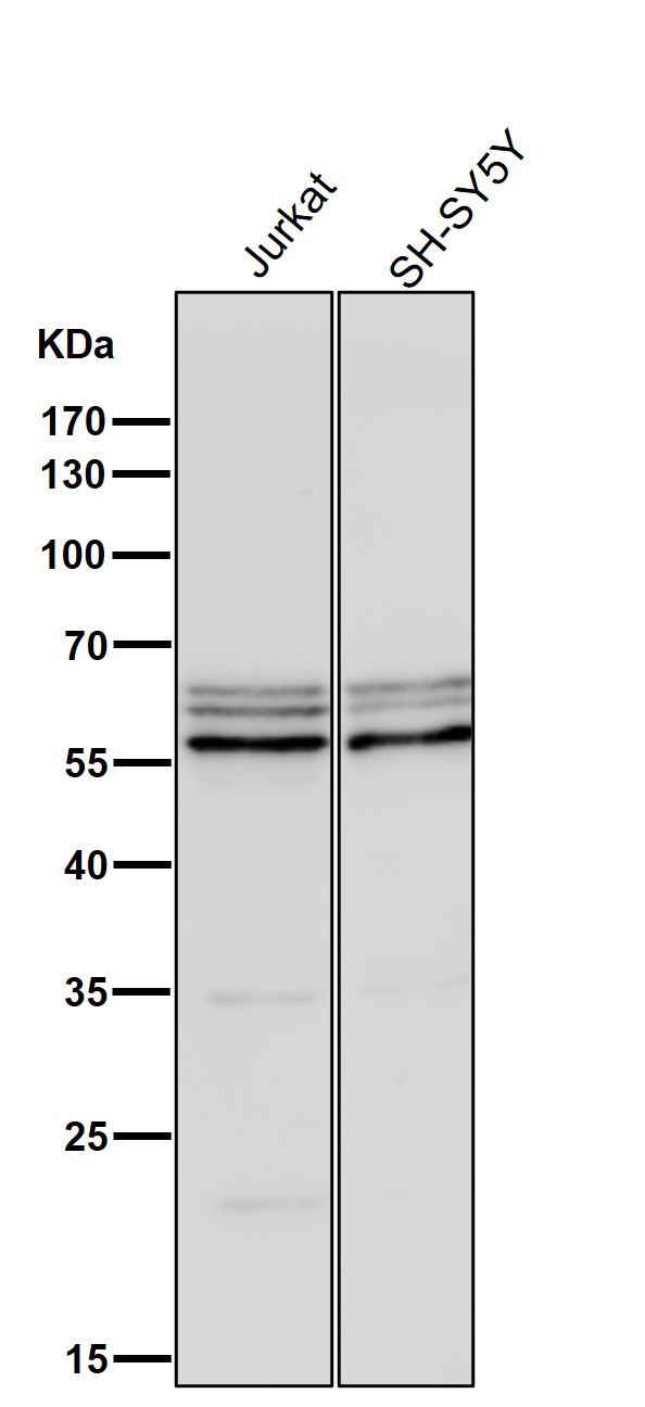 1 - Anti-Phospho-AKT1 (S124) Rabbit Monoclonal Antibody ABO13146