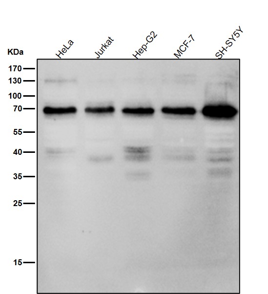 1 - Anti-Phospho-Raf1 (S621) Rabbit Monoclonal Antibody ABO13148