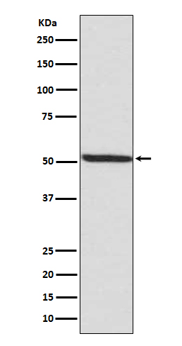 1 - Anti-Phospho-IRF3 (S386) Rabbit Monoclonal Antibody ABO13151