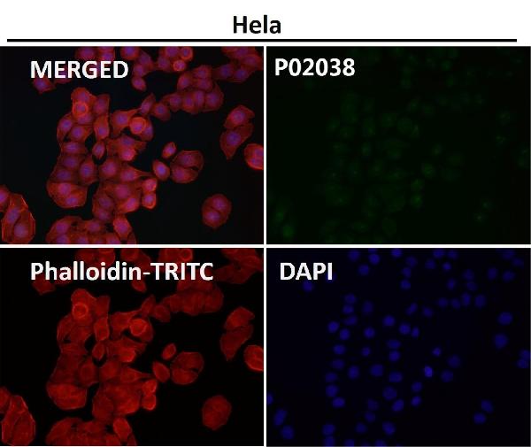 1 - Anti-Phospho-c-Jun (S63) Rabbit Monoclonal Antibody ABO13152