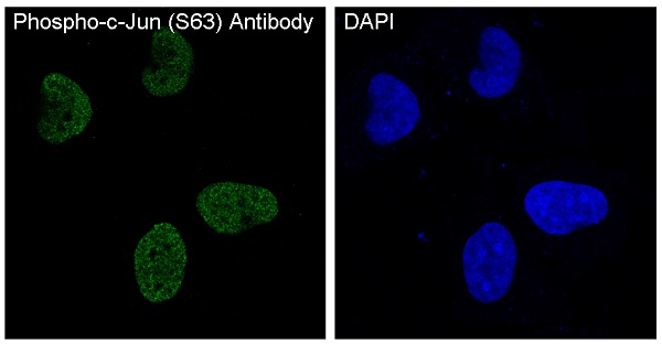 3 - Anti-Phospho-c-Jun (S63) Rabbit Monoclonal Antibody ABO13152