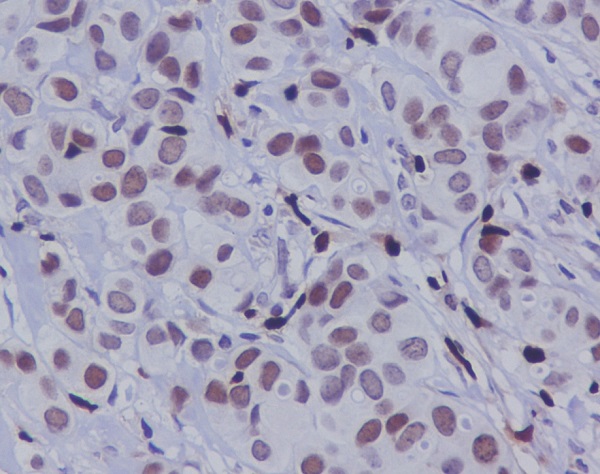 2 - Anti-Phospho-c-Jun (S63) Rabbit Monoclonal Antibody ABO13152