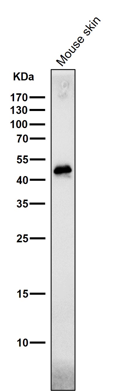 1 - Anti-Phospho-c-Jun (S63) Rabbit Monoclonal Antibody ABO13152