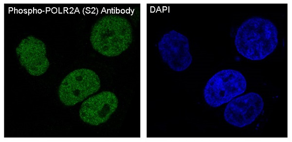 3 - Anti-Phospho-POLR2A (S2) Rabbit Monoclonal Antibody ABO13153