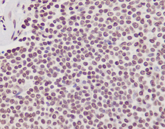 2 - Anti-Phospho-POLR2A (S2) Rabbit Monoclonal Antibody ABO13153