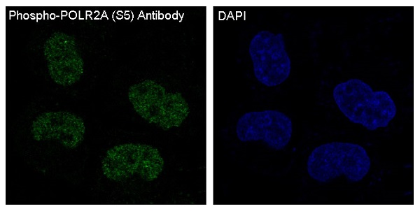 3 - Anti-Phospho-POLR2A (S5) Rabbit Monoclonal Antibody ABO13154