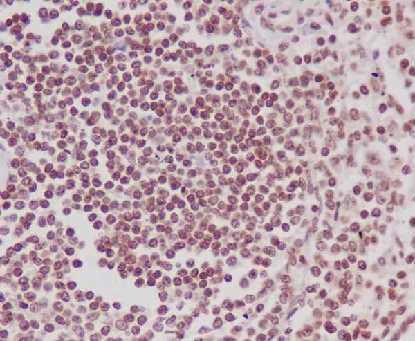 2 - Anti-Phospho-POLR2A (S5) Rabbit Monoclonal Antibody ABO13154