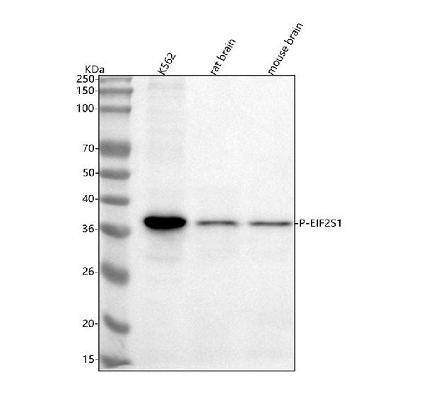 1 - Anti-Phospho-EIF2S1 (S51) Rabbit Monoclonal Antibody ABO13155