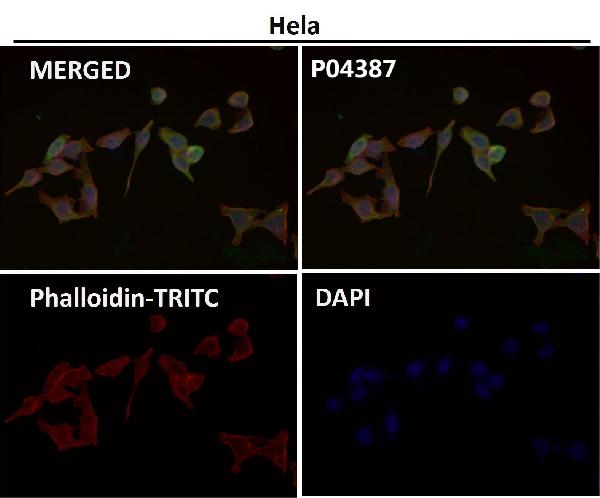 1 - Anti-Phospho-EIF2S1 (S51) Rabbit Monoclonal Antibody ABO13155