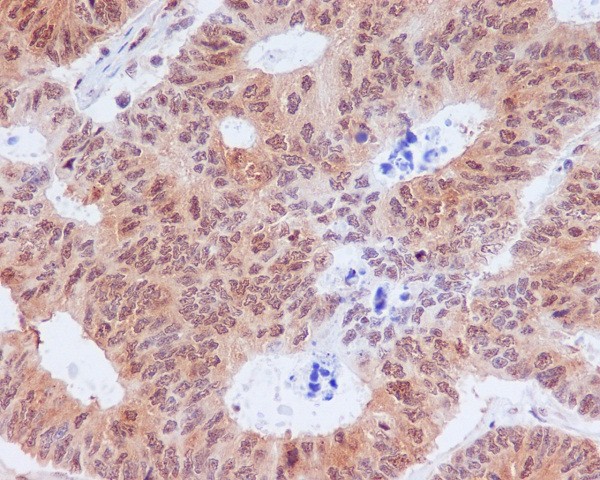 2 - Anti-Phospho-EIF2S1 (S51) Rabbit Monoclonal Antibody ABO13155