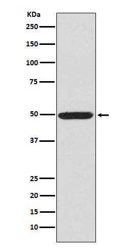 1 - Anti-Phospho-PKA R2 (S99) PRKAR2A Rabbit Monoclonal Antibody ABO13156