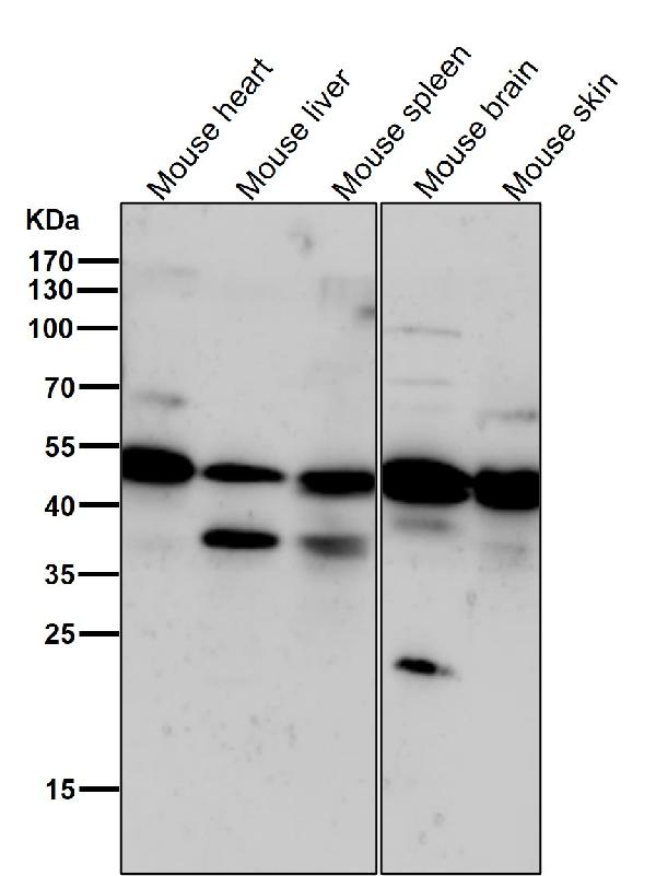 1 - Anti-Phospho-PKA R2 (S99) PRKAR2A Rabbit Monoclonal Antibody ABO13156