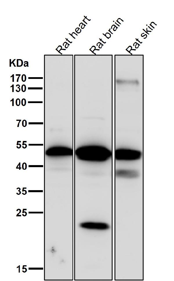 1 - Anti-Phospho-PKA R2 (S99) PRKAR2A Rabbit Monoclonal Antibody ABO13156