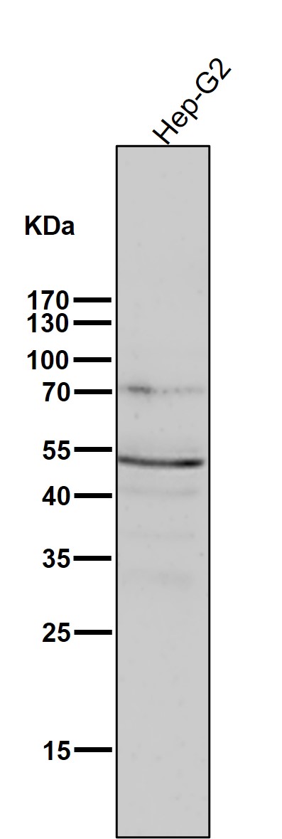 1 - Anti-Phospho-PKA R2 (S99) PRKAR2A Rabbit Monoclonal Antibody ABO13156