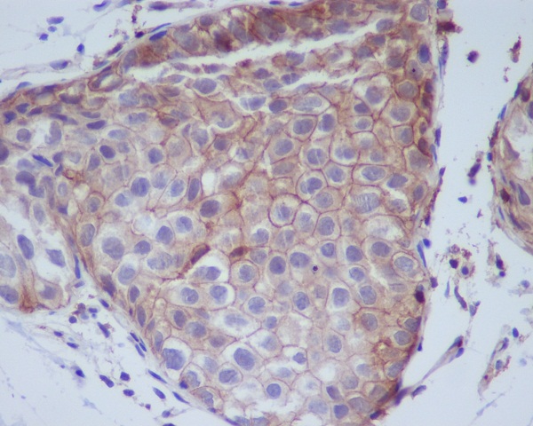 2 - Anti-Phospho-EGFR (Y1092) Rabbit Monoclonal Antibody ABO13157
