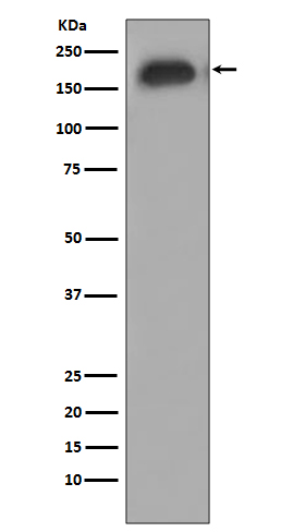 1 - Anti-Phospho-EGFR (Y1092) Rabbit Monoclonal Antibody ABO13157