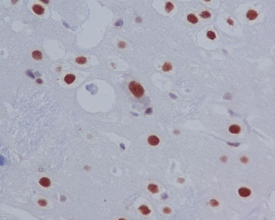2 - Anti-Phospho-STAT3 (S727) Rabbit Monoclonal Antibody ABO13159