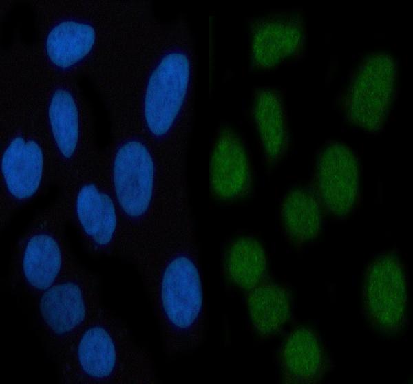 3 - Anti-Phospho-STAT3 (S727) Rabbit Monoclonal Antibody ABO13159