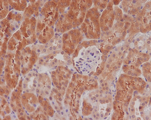 2 - Anti-Phospho-eIF4E (S209) Rabbit Monoclonal Antibody ABO13160