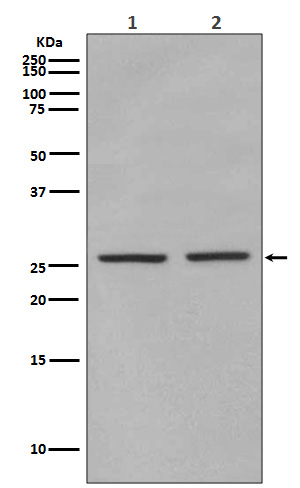 1 - Anti-Phospho-eIF4E (S209) Rabbit Monoclonal Antibody ABO13160