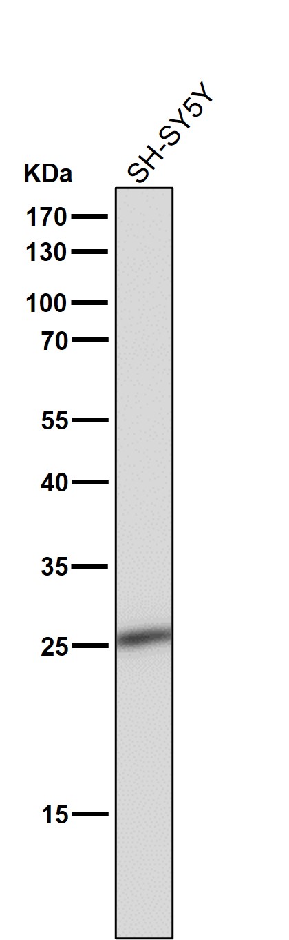 1 - Anti-Phospho-eIF4E (S209) Rabbit Monoclonal Antibody ABO13160