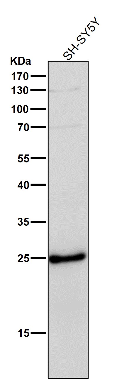1 - Anti-Phospho-eIF4E (S209) Rabbit Monoclonal Antibody ABO13160