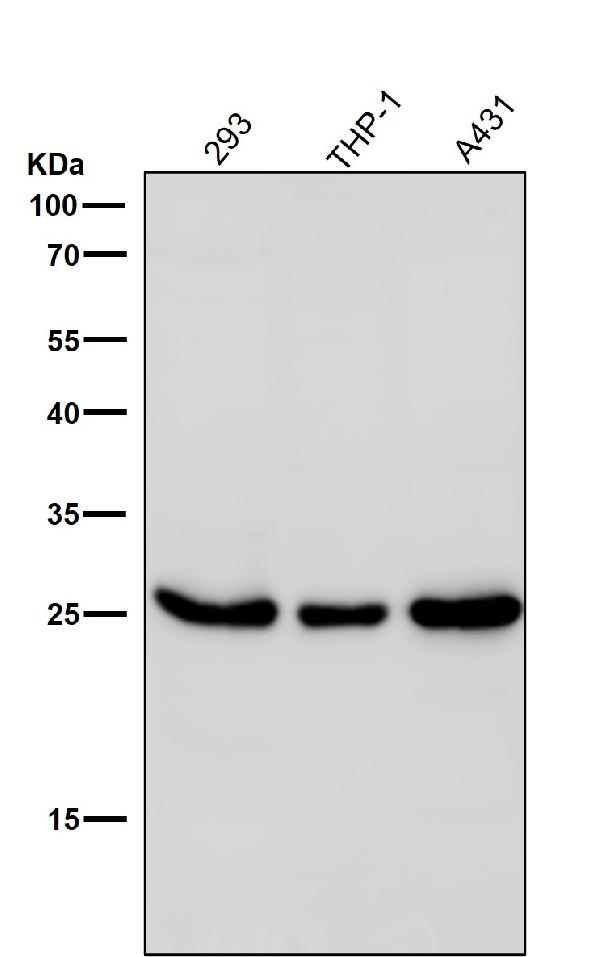 1 - Anti-Phospho-eIF4E (S209) Rabbit Monoclonal Antibody ABO13160