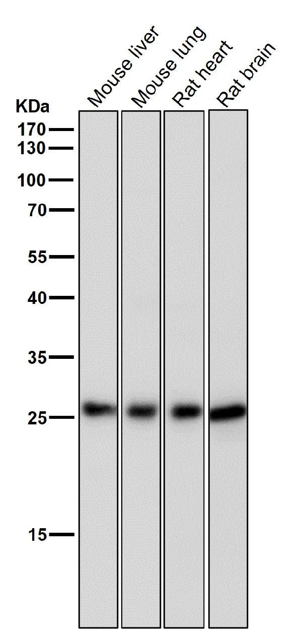 1 - Anti-Phospho-eIF4E (S209) Rabbit Monoclonal Antibody ABO13160