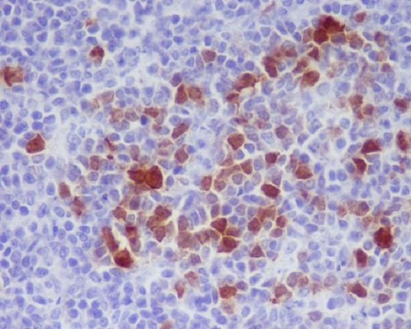 2 - Anti-Phospho-Cdk1/2 (T14) Rabbit Monoclonal Antibody ABO13161
