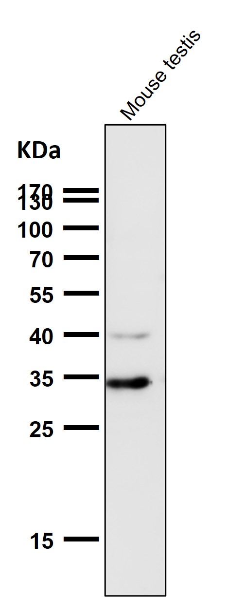 1 - Anti-Phospho-Cdk1/2 (T14) Rabbit Monoclonal Antibody ABO13161