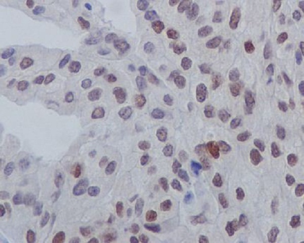 2 - Anti-Phospho-GATA3 (S308) Rabbit Monoclonal Antibody ABO13162