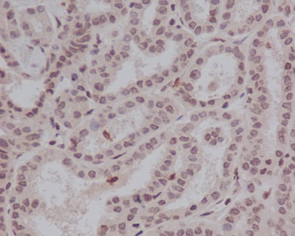 2 - Anti-Phospho-Stat5 (Y694) STAT5A Rabbit Monoclonal Antibody ABO13163