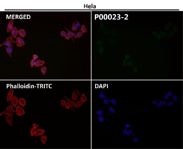 1 - Anti-Phospho-EGFR (Y1173) Rabbit Monoclonal Antibody ABO13165