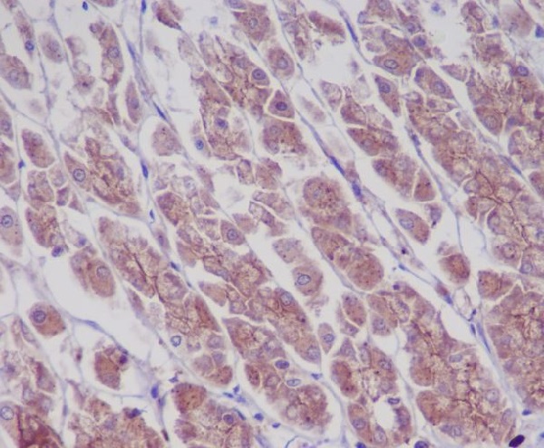 2 - Anti-Phospho-EGFR (Y1173) Rabbit Monoclonal Antibody ABO13165