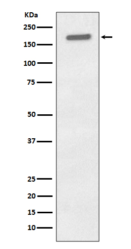 1 - Anti-Phospho-EGFR (Y1173) Rabbit Monoclonal Antibody ABO13165