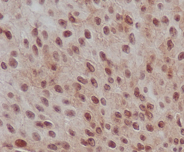 2 - Anti-Phospho-Smad2 (S255) Rabbit Monoclonal Antibody ABO13169