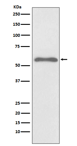 1 - Anti-Phospho-Smad2 (S255) Rabbit Monoclonal Antibody ABO13169