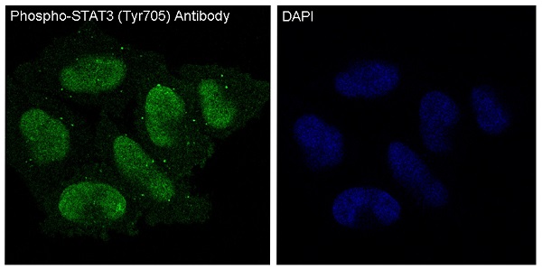 3 - Anti-Phospho-STAT3 (Y705) Rabbit Monoclonal Antibody ABO13174