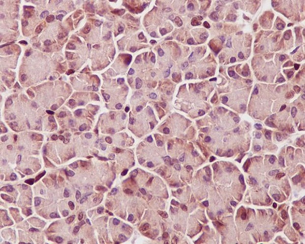2 - Anti-Phospho-STAT3 (Y705) Rabbit Monoclonal Antibody ABO13174