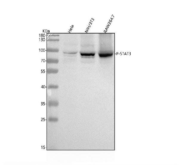 1 - Anti-Phospho-STAT3 (Y705) Rabbit Monoclonal Antibody ABO13174