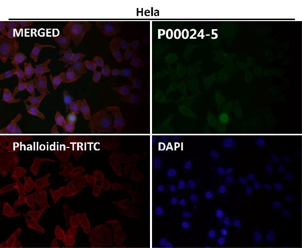 1 - Anti-Phospho-Akt (Ser473) AKT1 Rabbit Monoclonal Antibody ABO13175
